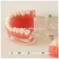 China Medical Anatomical Model Removable Soft Gingiva Standard Dental Jaw Model 13017